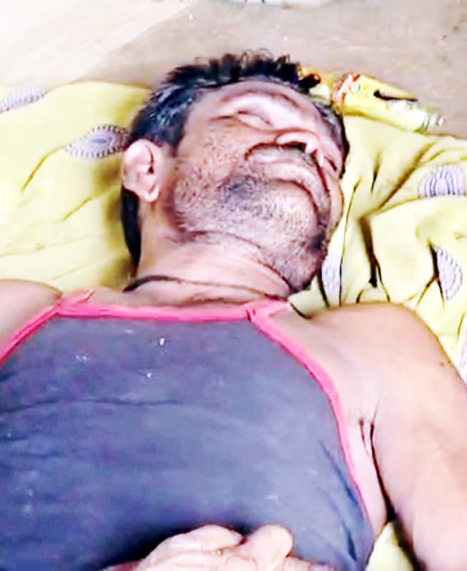 गरेला खदान में हादसा